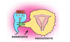 多囊阴道出血怎么试管？排卵期阴道出血是怎么回事